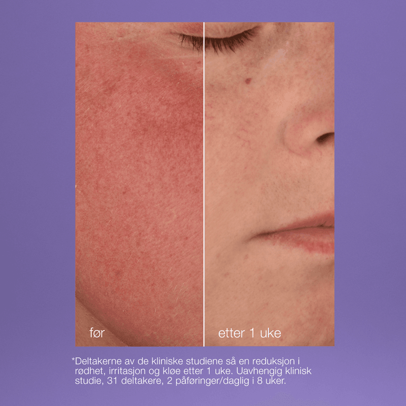 Stabilizing Repair Cream