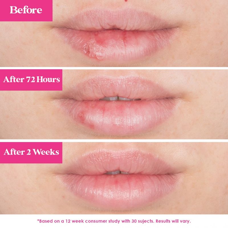 GrandePOUT Plumping Lip Mask Peach